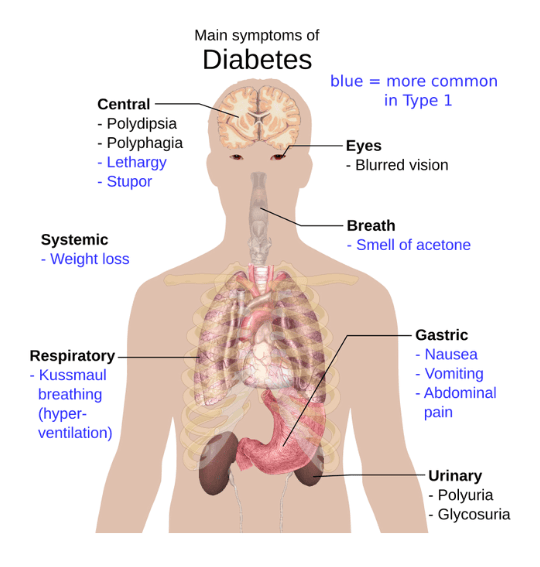 Read more about the article Diabetes Mellitus: Ultimate Guide to this very preventable illness